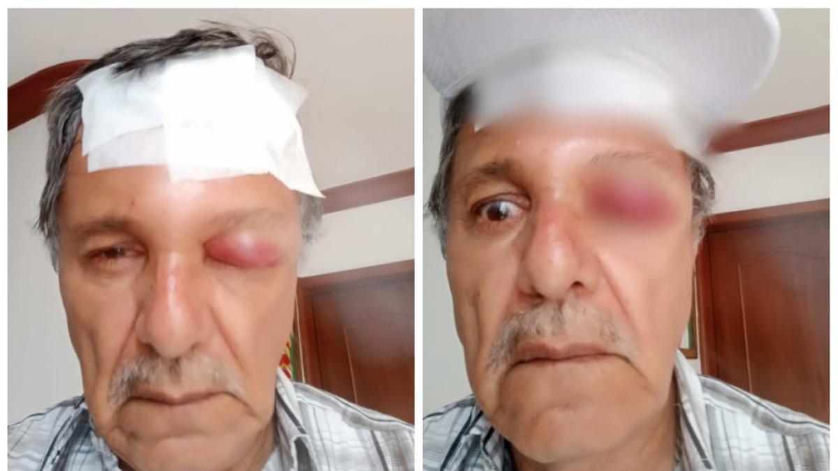 De esta manera, un camarógrafo atacado por un motociclista en Cali

 – Desde dentro