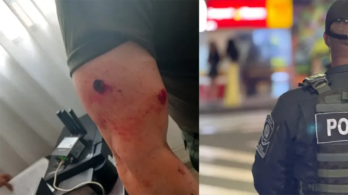 El comandante operativo de la policía de Antioquia resultó herido en el asignado

 – Desde dentro