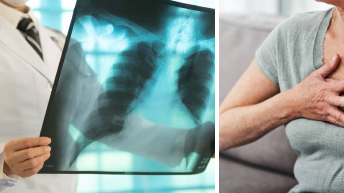 Dadis informa más de 300 casos de tuberculosis hasta 2025.

 – Desde dentro